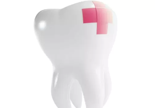 A model of a damaged tooth is seen. Associates In Dentistry offers Emergency Dental Care.