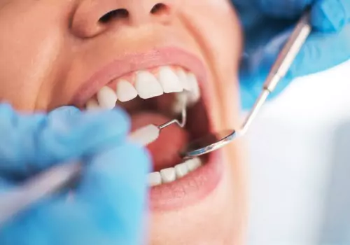 A woman having her teeth checked during her visit to a dentist near you in Peoria IL