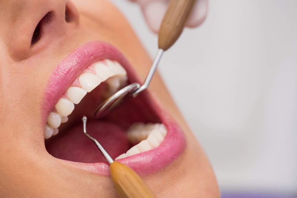 Image of Teeth Cleaning Matter