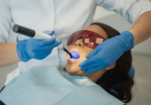 Image of Cavity treatment