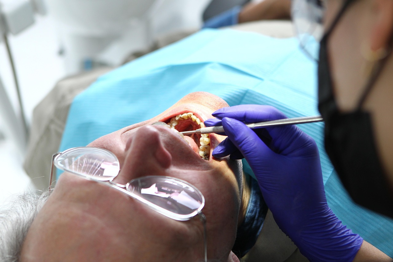Image of teeth extraction