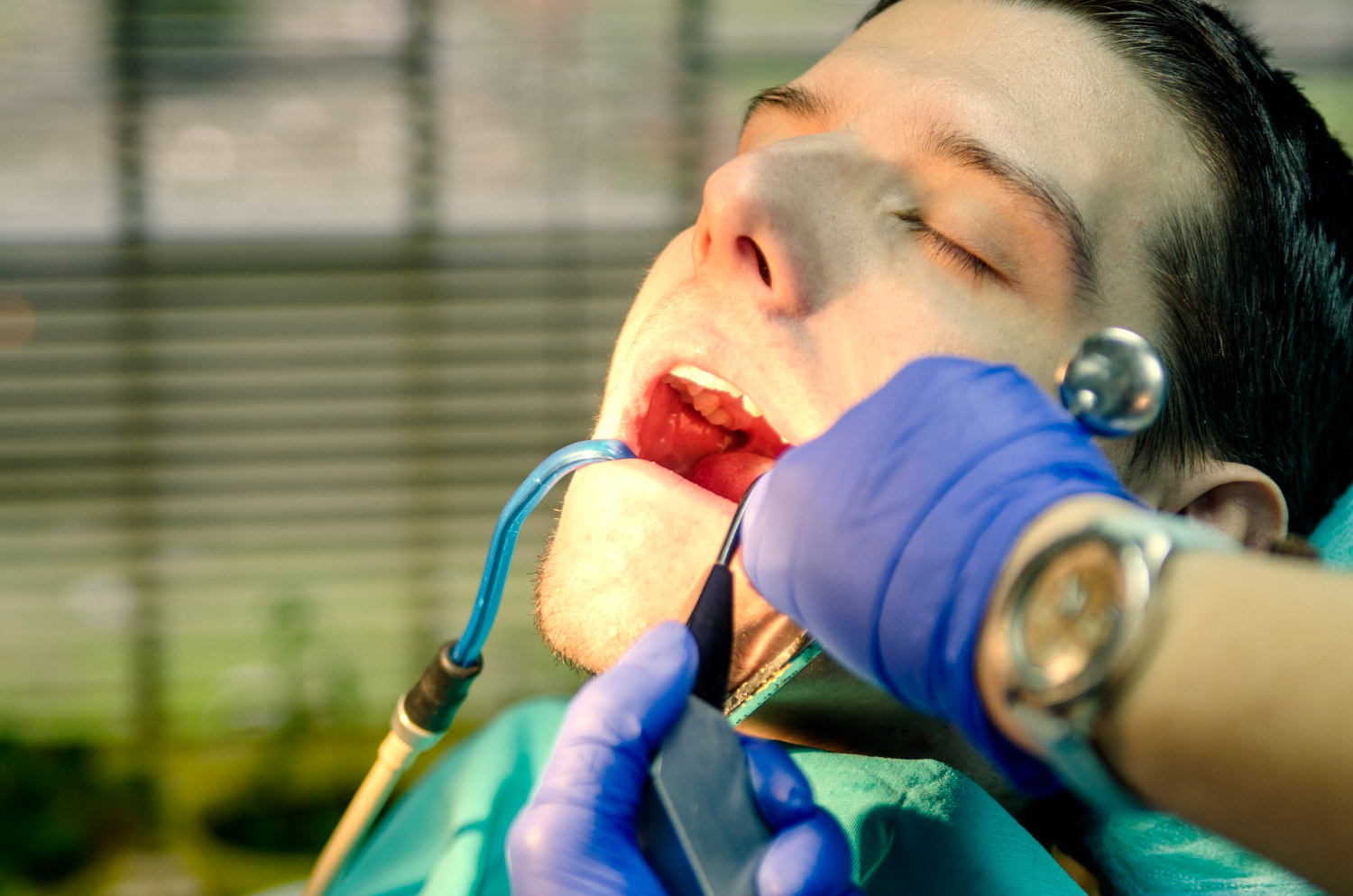 Image of Cavity treatment Dentistry
