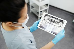 Image of Dental X-Rays
