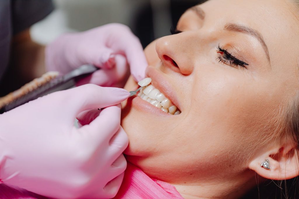 Image of Porcelain veneers