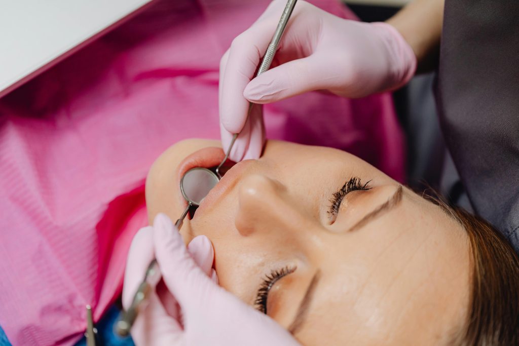 Image of Dental bonding