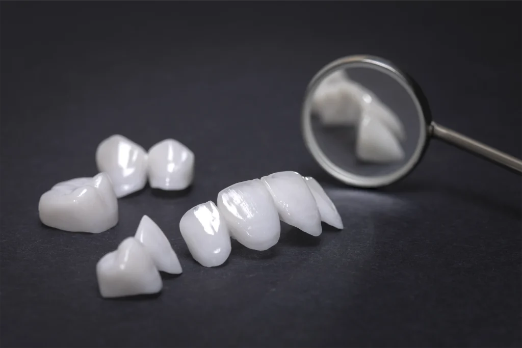 Image of porcelain veneers and dental restorations displayed with a dental mirror for cosmetic smile enhancement in Illinois
